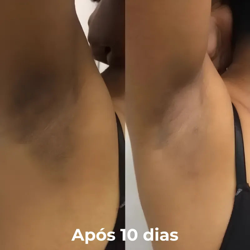 Spray Super Clareador Instantâneo para Axilas e Virilhas