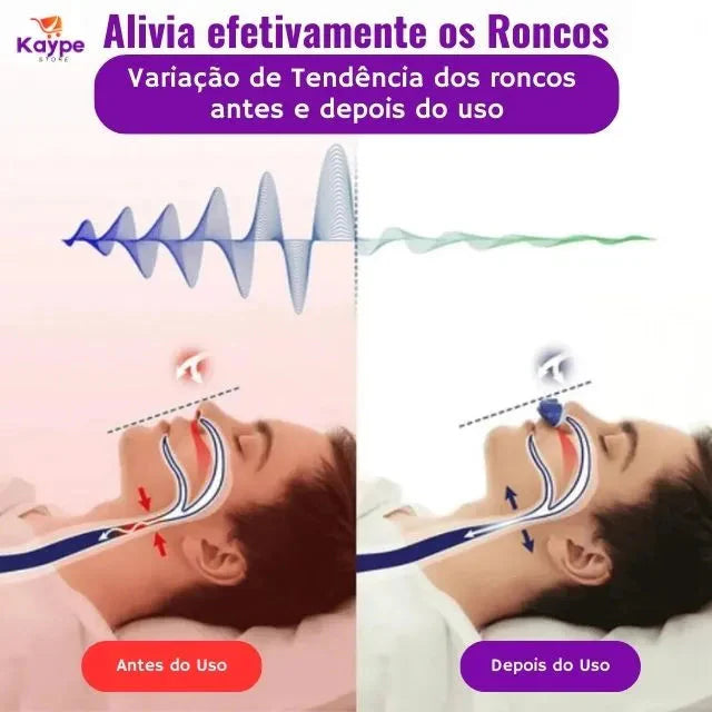 Anti Ronco Eletrônico Micro-CPAP - Sem tubo, Sem Máscara e Sem fios - SleepGuardian